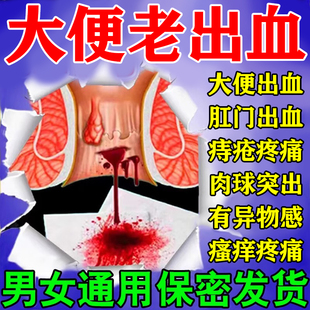 治痔疮大便出血止血的专用药内外混合痔肛裂肛门瘙痒屁眼痒槐角丸
