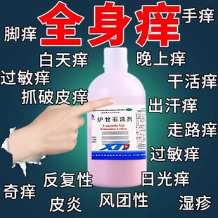 炉甘石洗剂湿疹皮炎止痒药皮肤瘙痒治痱子治疗特荨麻疹过敏的效药
