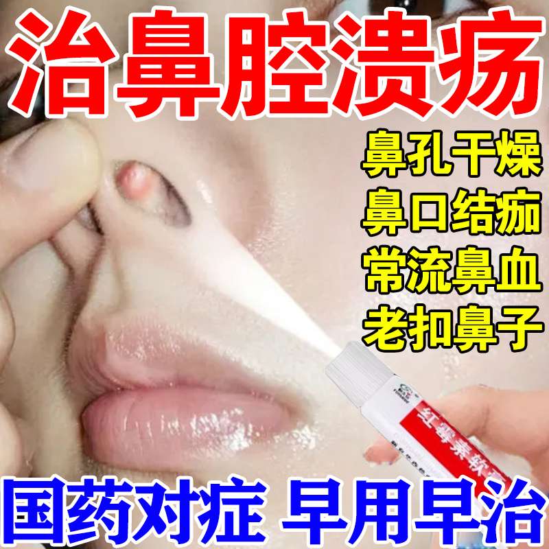 鼻子干燥结痂出血鼻腔溃疡