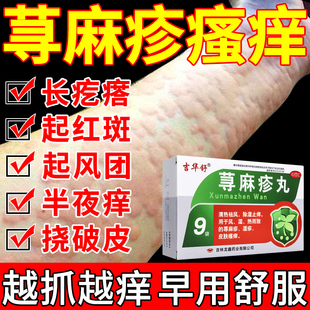 皮肤瘙痒止痒断痒根专用药抑菌全身痒吃什么药湿疹荨麻疹过敏药丸