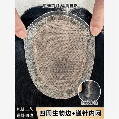 递针仿真假发男士短发生物头皮真发头顶补发发际线超薄膜高端帅气