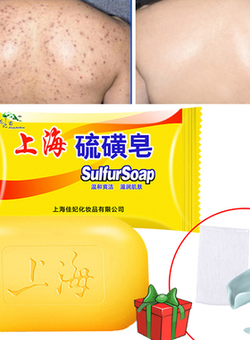 Shanghai Sulfur Soap Bath Oil-Control Acne Eczema Anti Facia