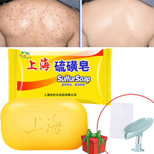 Shanghai Sulfur Soap Bath Oil-Control Acne Eczema Anti Facia