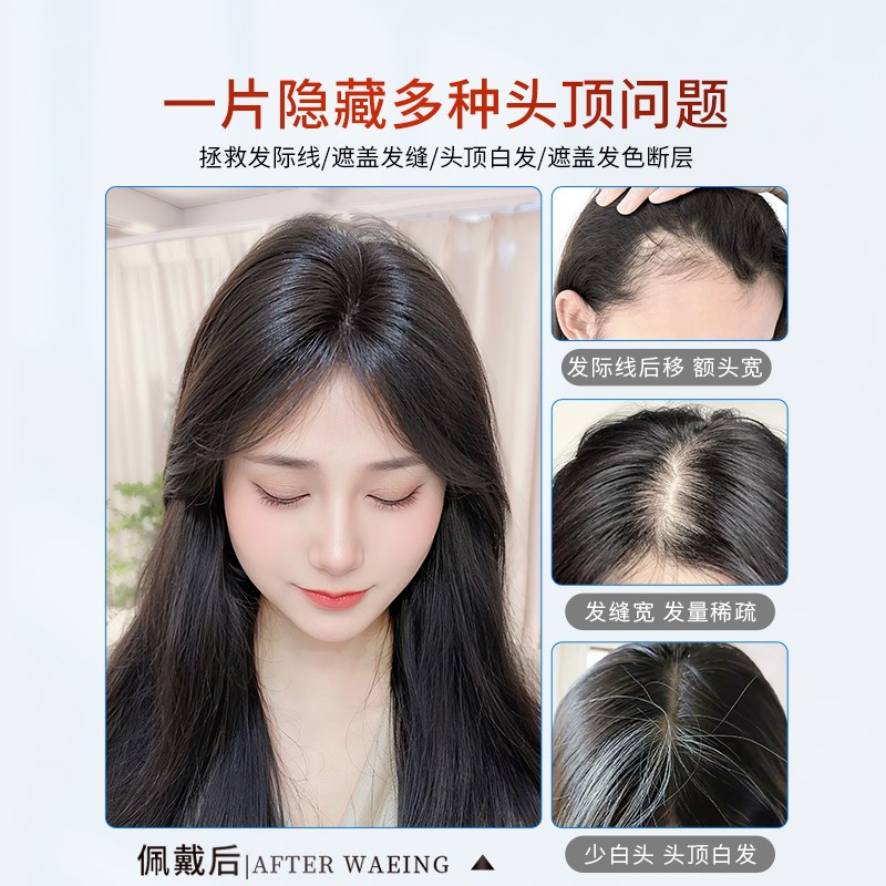递针假发女片头顶真发高颅顶遮白发蓬松增发量隐形无痕刘海补发片