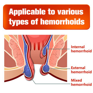 Hemorrhoids Ointment  fast Therapy Shrinks and soothes hemor