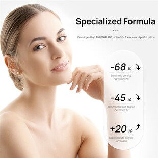 Face Blackheads Remover Peel Off Black Dots Mask Skin Care P