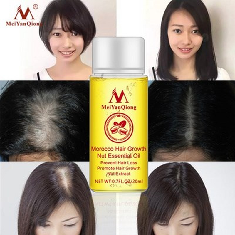 fast Hair Growth Essence anti Hair Loss Products Oil Liquid