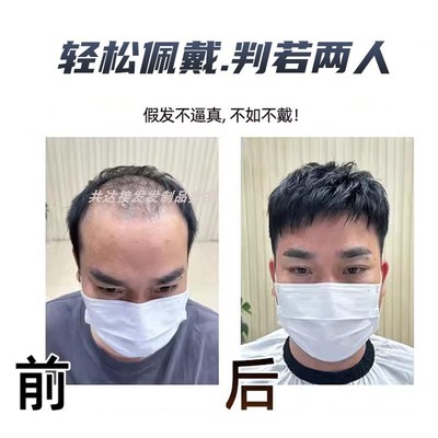 男士假发npu递针手工钩织真人发丝隐形无痕整顶补发短直发轻薄透
