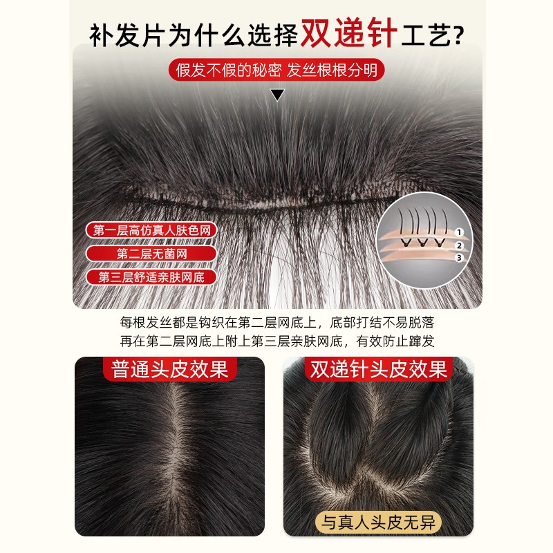 双递针假发片女头顶真发遮白发蓬松增发量高颅顶轻薄款无痕补发片