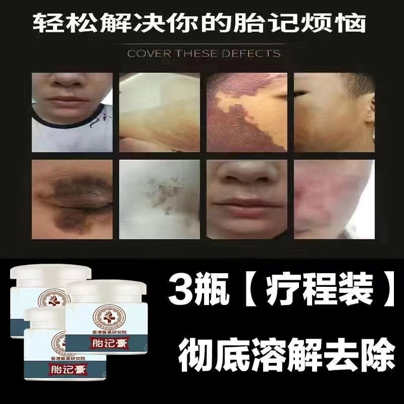 胎记去除神器脸部黑色素太田咖啡斑淡化黑色红色去祛除天生胎记膏