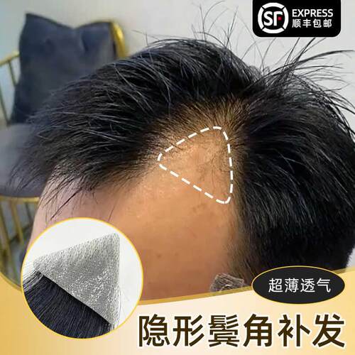 男女士鬓角疤痕斑秃无痕补发片全真发丝短发隐形逼真假发帅气男生
