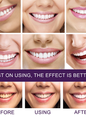 30/60ml Teeth Cleansing Whitening Mousse Removes Stains Teet