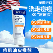 PanOxyl10%bpo过氧化苯甲酰祛痘洗面奶控油去痘洁面乳青少年 临期