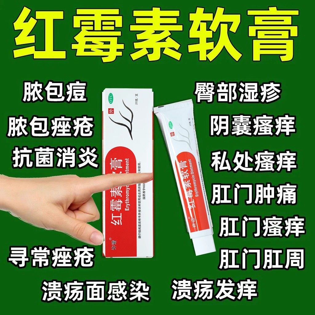 红霉素软膏正品消炎官方旗舰店罗红霉素膏外用婴儿私处