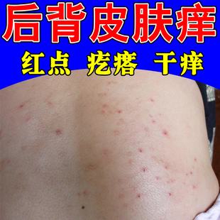 身上痒起小点疙瘩痒后背小腿痒皮痒背上腿部粗糙燥痒