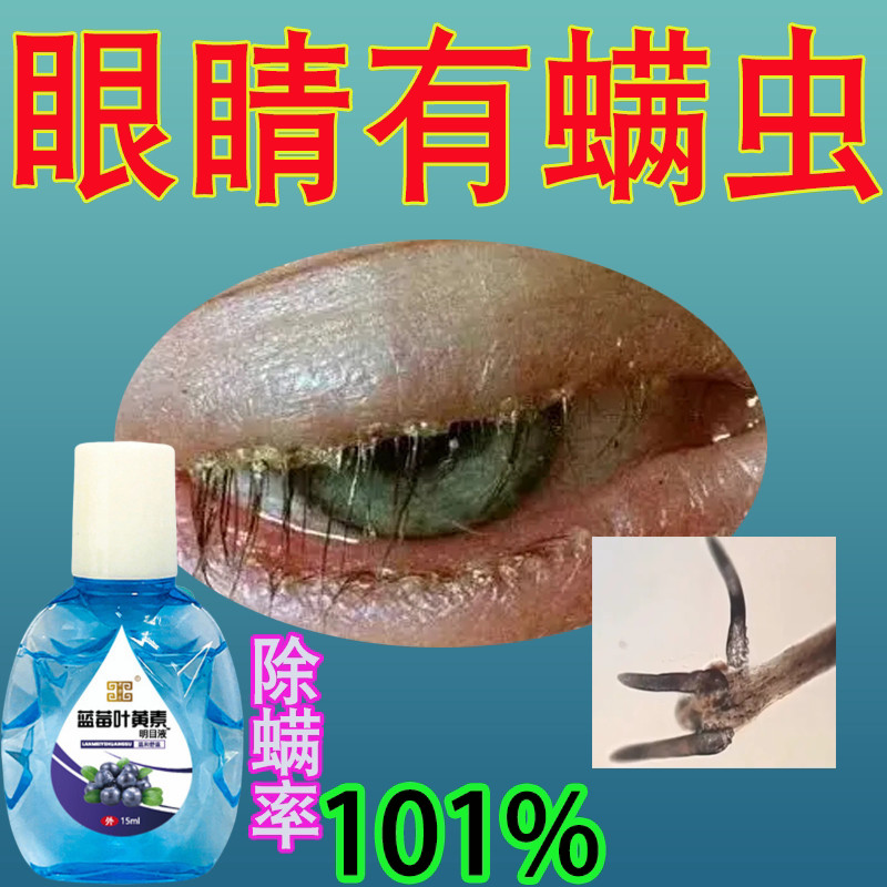 眼睛有螨虫睫毛根部痒眼角眼皮眼球发痒止异物感消焱杀菌滴眼液痒