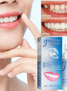 Dentes e gap dentes falsos slido cola resina faltando dent