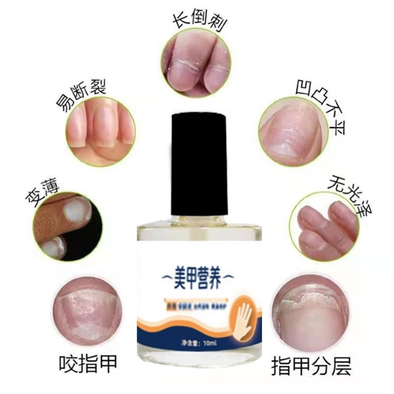 指甲修复液受损再生养甲床增厚薄软竖纹滋养保护理生长水营养液油