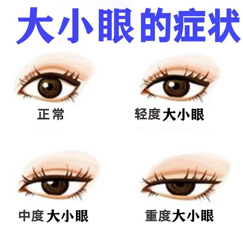 大小眼矫c正器改善上眼睑肌无力非双眼皮贴眼皮下垂提拉紧致防松