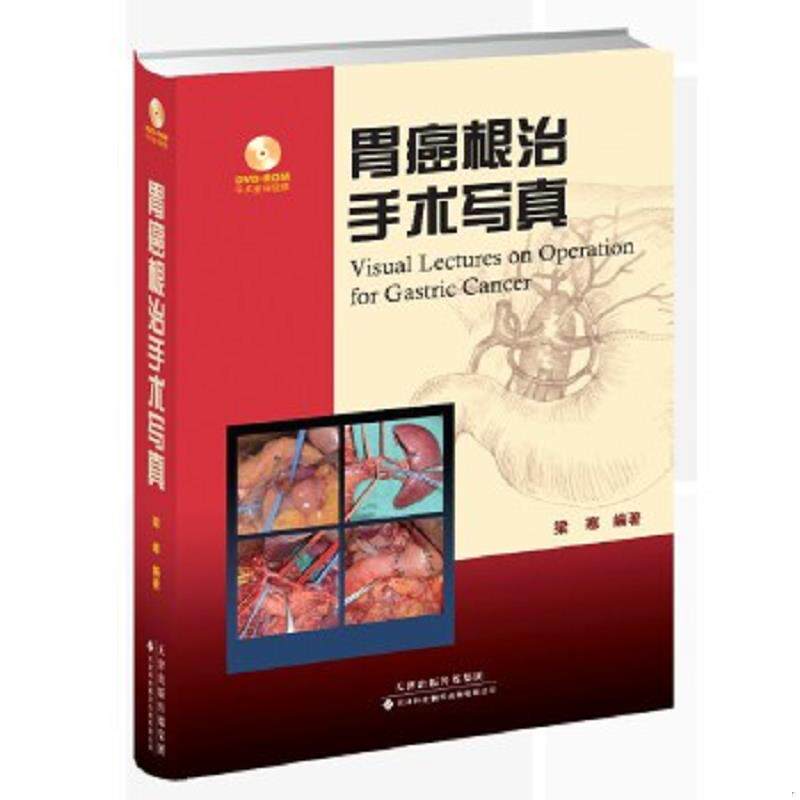 正版速发9787543332249 胃癌根治手术写真 带光盘 梁寒 天津科技翻译出版公司