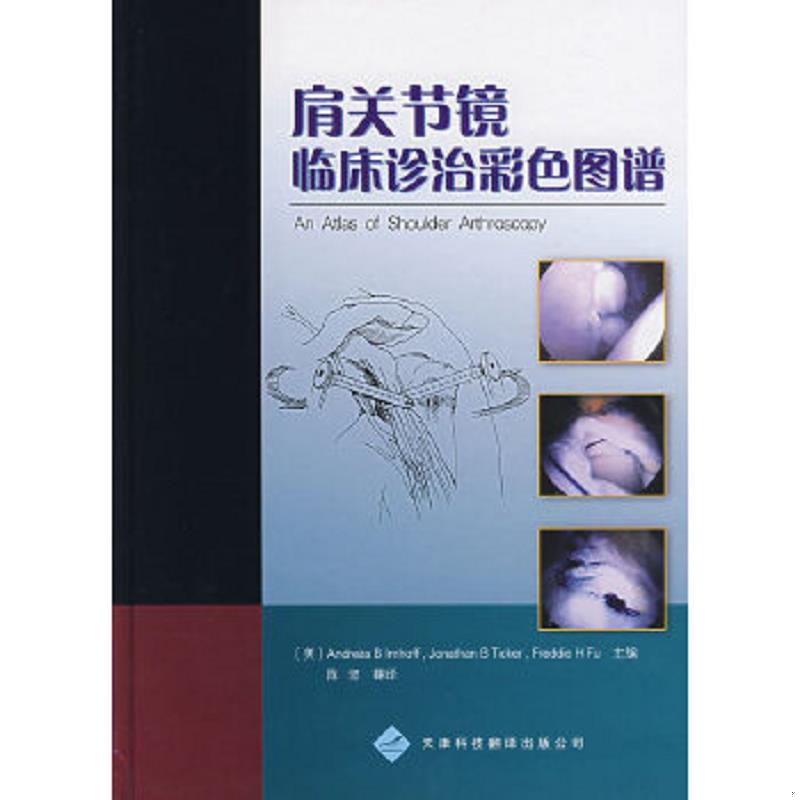 正版速发9787543321182 肩关节镜临床诊治彩色图谱 品相看图 （美）安缀斯等主编,陈坚译 天津科技翻译出版公司