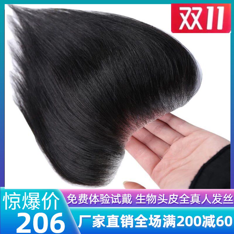 男女发际线前额补发片刘海假发贴全真人发高额头补发M型无痕隐形