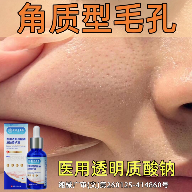 【痘痘救星】角质型痘印坑修复闭口收缩毛孔粗大透明质酸钠精华液