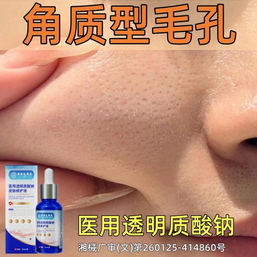 【香港大药房】正品修复痘印闭口收缩毛孔粗大透明质酸钠精华液