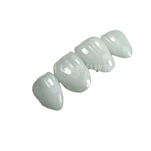 全瓷贴面德国义获嘉超薄高端专业技术马里兰桥制做牙齿美白贴面