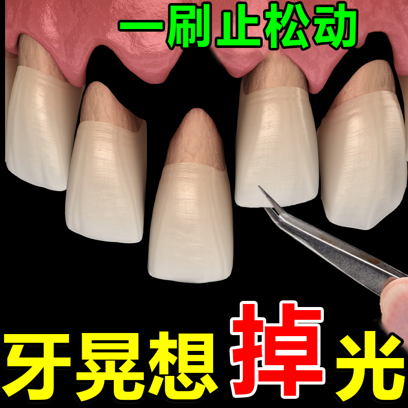 【一刷止牙松】牙齿晃动修复再生牙龈退缩齿根外漏固齿专用牙膏YF