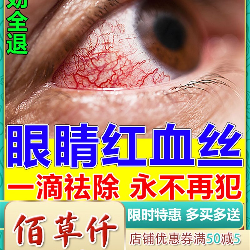眼睛红血丝修复去除眼睛去黄去红血丝缓解眼疲劳眼水粘稠滴眼液