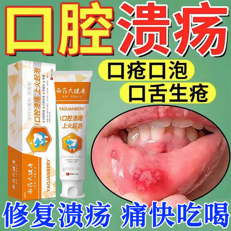 防口腔溃疡专用牙膏美克舒益生菌牙周炎去异味儿童嘴上火除口臭VV