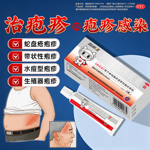 玛尚廷阿昔洛韦乳膏疱疹感染