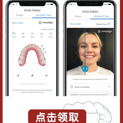 隐形牙套方案设计 取牙模材料牙齿定制矫正包 成人保持器透明牙箍