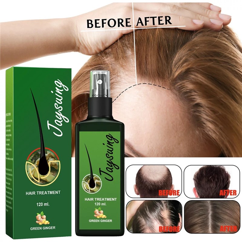 Hair Lotion Growth Root Fall Loss Sideburn Nutrient Wealth