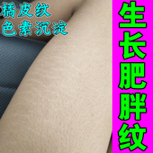 去肥胖纹生长纹修复霜消除大腿学生腰腹上肥胖纹去除男女通用药膏