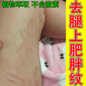 去腿上肥胖纹红色纹路修复霜大腿胳膊内侧长白色纹路粗糙干燥膨胀