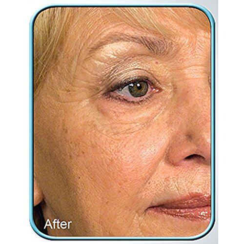 极速Biologic Stem Cell Wrinkle Therapy - (Set of 2)