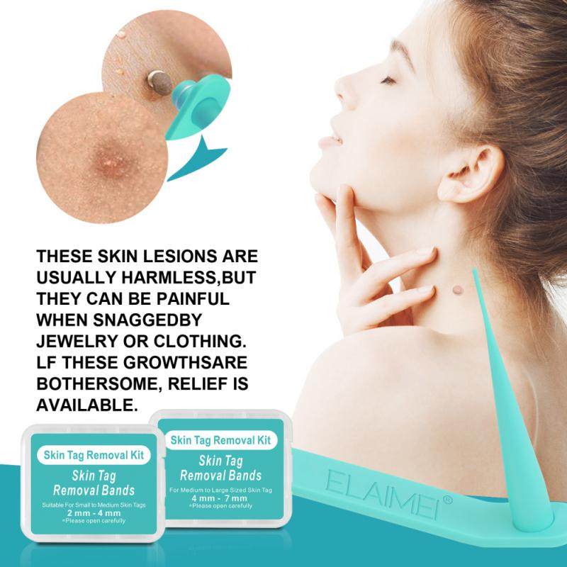 2 IN 1 Skin Tag Removal Kit Home Use Mole Wart Remover Equip
