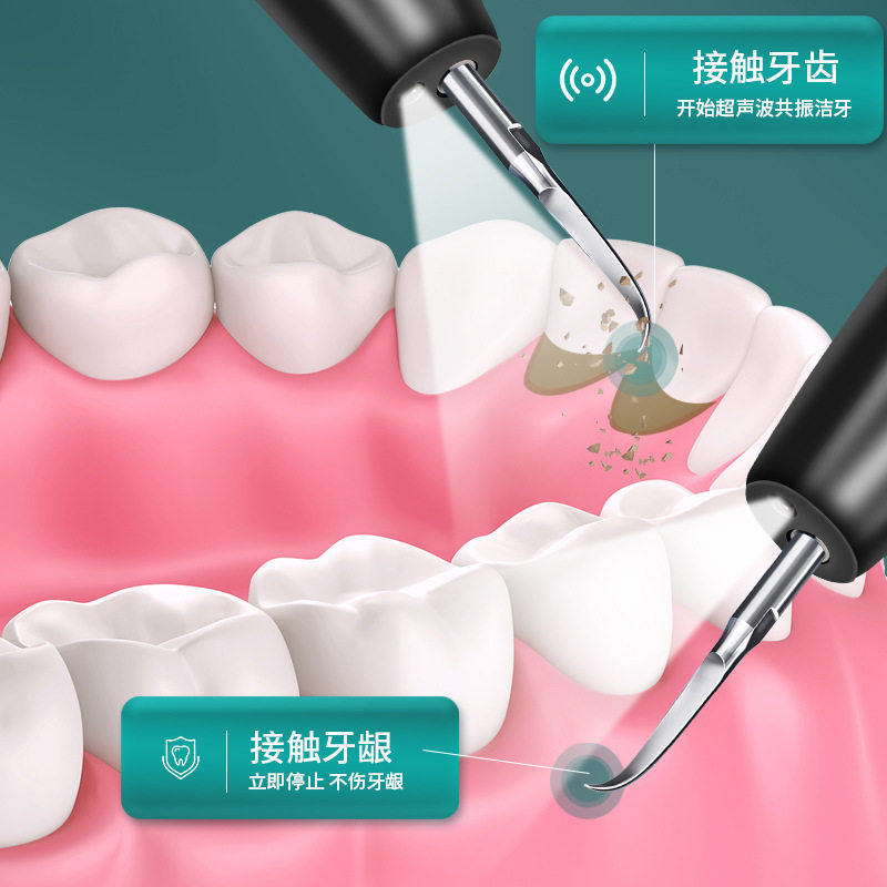 超声波家用洁牙器洗牙齿清洁美牙仪洗牙器去除牙结石美白牙垢