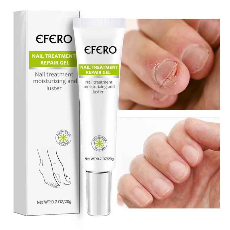 .Hot Efero Fungal Nail  Repair Essence Foot Nail Fungus