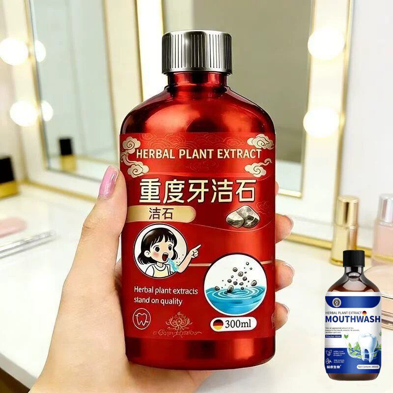 【重度牙结石】牙石溶解漱口水洗牙齿污垢牙垢牙黄牙渍清理通用