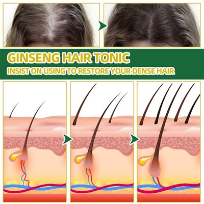 Preventing Hair Loss Liquid Damage Ginseng Hair Growth Serum