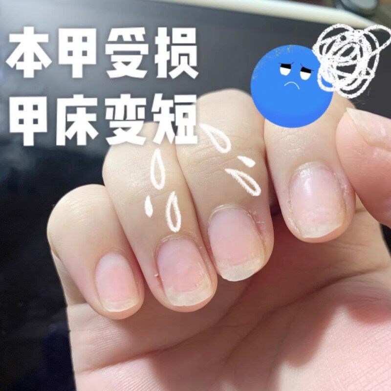 热销宝宝防咬啃手指甲神器儿童纠正器小孩手指头戒吃防抠手指甲保