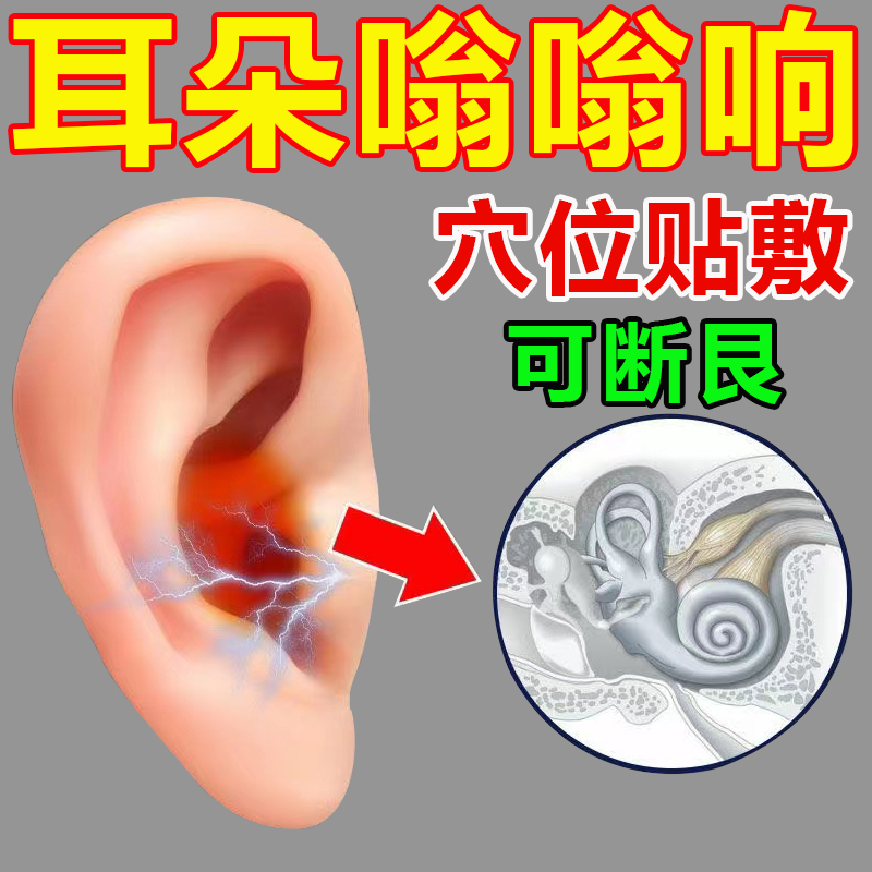 10万人都在用【爆款热销】耳不鸣耳不嗡 限时优惠 买2发3 买3发5