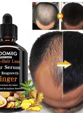好货Hair Growth Products Natural Anti Hair Loss Prevent Bald
