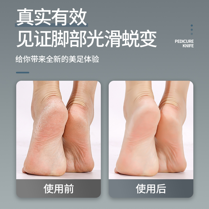 修脚刀去死皮老茧刮脚刀修脚器脚皮套装磨脚神器脚皮工具脚后跟刨