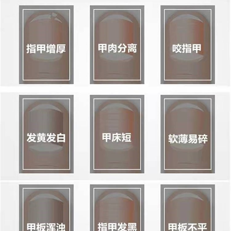 甲牀增长液分裂指甲变厚变硬增厚发黄空甲肉分离受损再生修复工具