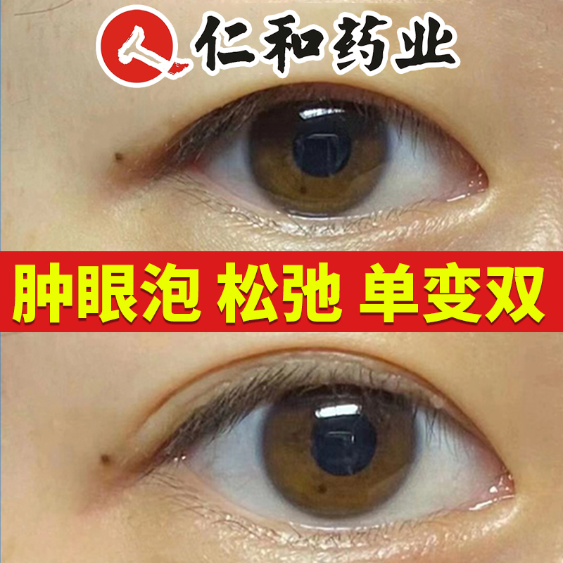 肿眼泡去肿玻色因眼霜上眼皮松弛下垂提拉紧致内双变外开眼角神器