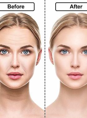 18pcs Reusable Silicone Patches Anti Rimpel Pads Wrinkle Rem